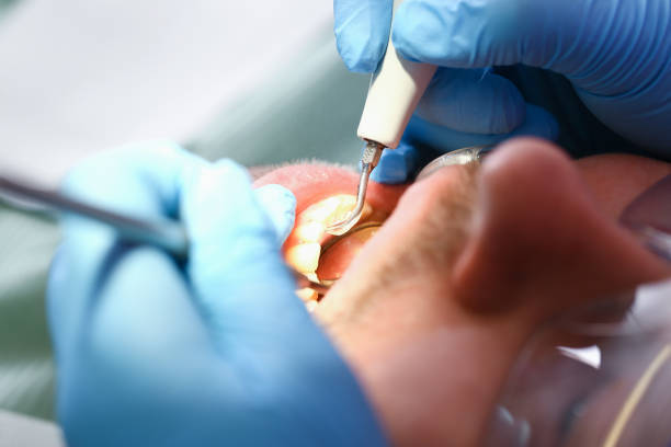 Best Emergency Wisdom Tooth Extraction in Elkins, AR